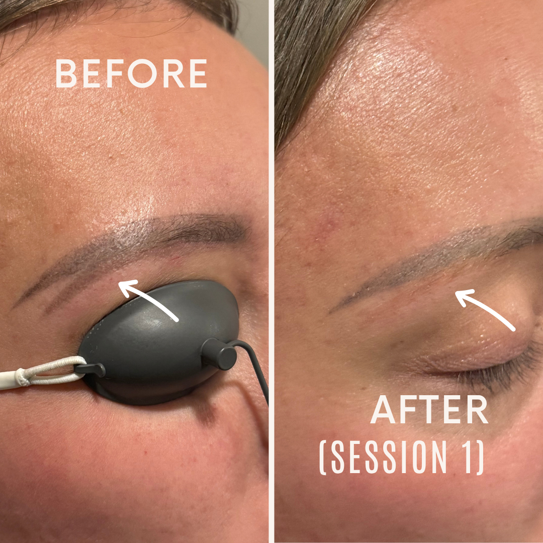 Before+after+minimal+skincare+Instagram+post+(1)