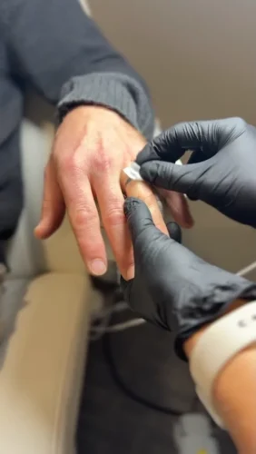 Tattoo Removal Service Coeur D’Alene Idaho 10