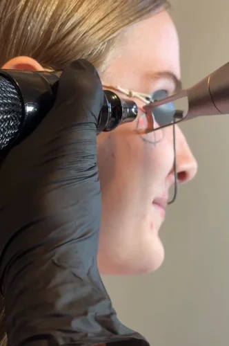 Tattoo Removal Service Coeur D’Alene Idaho 17