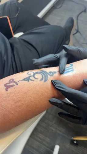 10-tulsa-tattoo-removal-service-IMG 20260804 092902