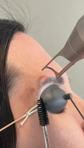 11-tulsa-tattoo-removal-service-IMG 20260804 092905