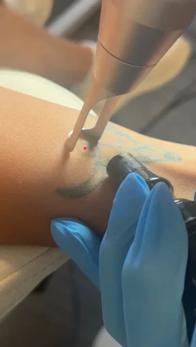 12-tulsa-tattoo-removal-service-IMG 20260804 092856