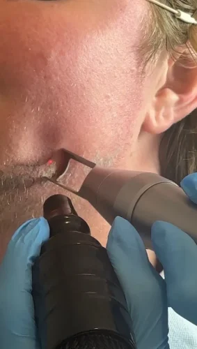 3-tulsa-tattoo-removal-service-IMG 20260804 092841