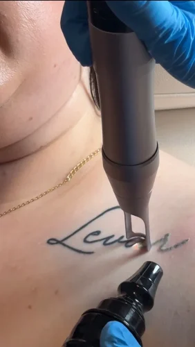 6-tulsa-tattoo-removal-service-IMG 20260804 092849