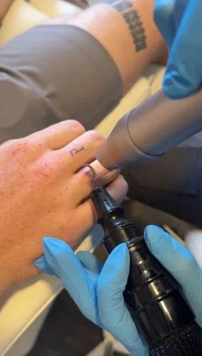 8-tulsa-tattoo-removal-service-IMG 20260804 092853